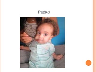 PEDRO

 