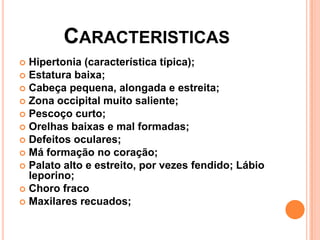 CARACTERISTICAS
Hipertonia (característica típica);
 Estatura baixa;
 Cabeça pequena, alongada e estreita;
 Zona occipital muito saliente;
 Pescoço curto;
 Orelhas baixas e mal formadas;
 Defeitos oculares;
 Má formação no coração;
 Palato alto e estreito, por vezes fendido; Lábio
leporino;
 Choro fraco
 Maxilares recuados;


 