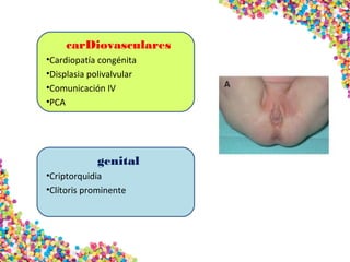 carDiovasculares
•Cardiopatía congénita
•Displasia polivalvular
•Comunicación IV
•PCA
genital
•Criptorquidia
•Clítoris prominente
 