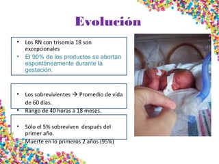 Evolución
• Los RN con trisomía 18 son
excepcionales
• El 90% de los productos se abortan
espontáneamente durante la
gestación.
• Los sobrevivientes  Promedio de vida
de 60 días.
• Rango de 40 horas a 18 meses.
• Sólo el 5% sobreviven después del
primer año.
• Muerte en lo primeros 2 años (95%)
 
