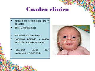 Cuadro clínico
• Retraso de crecimiento pre y
posnatal
• BPN ( 2340 gramos)
• Nacimiento postérmino.
• Panículo adiposo y masa
muscular escasa al nacer.
• Hipotonía inicial que
evoluciona a hipertonía.
 