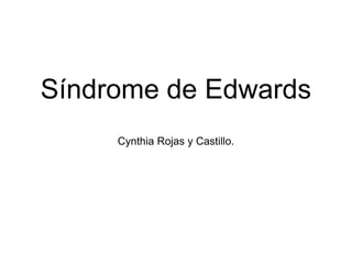 Síndrome de Edwards
Cynthia Rojas y Castillo.
 