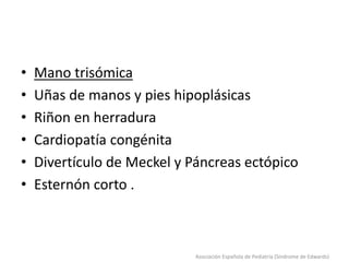 • Mano trisómica
• Uñas de manos y pies hipoplásicas
• Riñon en herradura
• Cardiopatía congénita
• Divertículo de Meckel y Páncreas ectópico
• Esternón corto .
Asociación Española de Pediatría (Síndrome de Edwards)
 