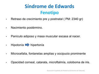Síndrome de Edwards
Fenotipo
• Retraso de crecimiento pre y postnatal ( PM: 2340 gr)
• Nacimiento postérmino.
• Panículo adiposo y masa muscular escasa al nacer.
• Hipotonía hipertonía
• Microcefalia, fontanelas amplias y occipucio prominente
• Opacidad corneal, catarata, microftalmía, coloboma de iris.
Asociación Española de Pediatría (Síndrome de Edwards)
 