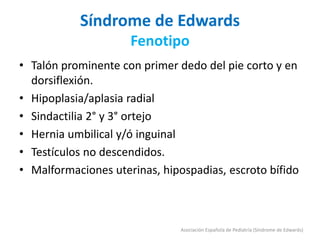 Síndrome de Edwards
Fenotipo
• Talón prominente con primer dedo del pie corto y en
dorsiflexión.
• Hipoplasia/aplasia radial
• Sindactilia 2° y 3° ortejo
• Hernia umbilical y/ó inguinal
• Testículos no descendidos.
• Malformaciones uterinas, hipospadias, escroto bífido
Asociación Española de Pediatría (Síndrome de Edwards)
 