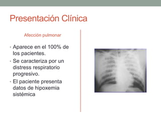 Presentación Clínica 
Afección pulmonar 
• Aparece en el 100% de 
los pacientes. 
• Se caracteriza por un 
distress respiratorio 
progresivo. 
• El paciente presenta 
datos de hipoxemia 
sistémica 
 