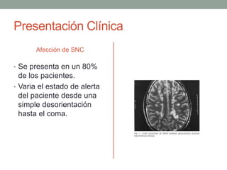 Presentación Clínica 
Afección de SNC 
• Se presenta en un 80% 
de los pacientes. 
• Varia el estado de alerta 
del paciente desde una 
simple desorientación 
hasta el coma. 
 