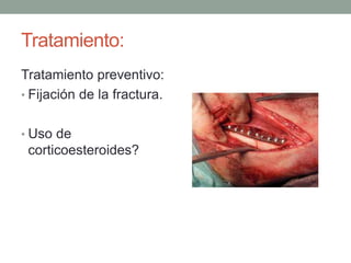 Tratamiento: 
Tratamiento preventivo: 
• Fijación de la fractura. 
• Uso de 
corticoesteroides? 
 