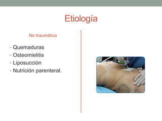 Etiología 
No traumática 
• Quemaduras 
• Osteomielitis 
• Liposucción 
• Nutrición parenteral. 
 