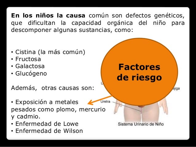 Síndrome de fanconi