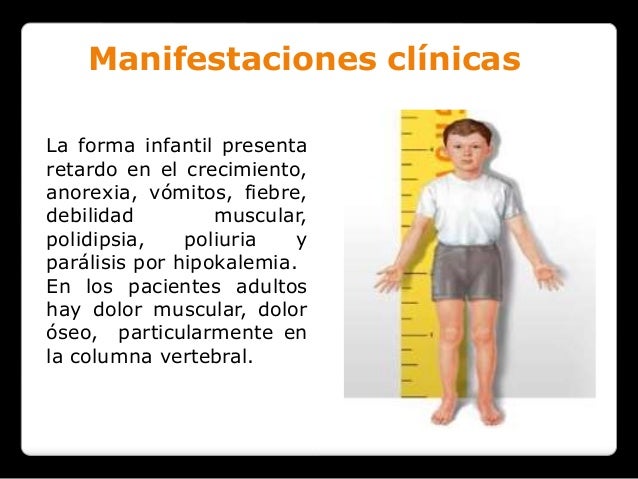 Como curar la osteocondrosis del departamento de pecho por los métodos públicos