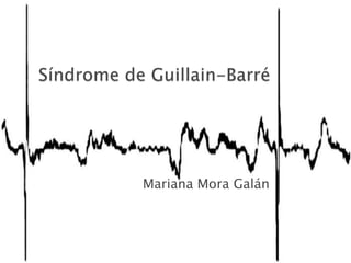Síndrome de Guillain-Barré Mariana Mora Galán 