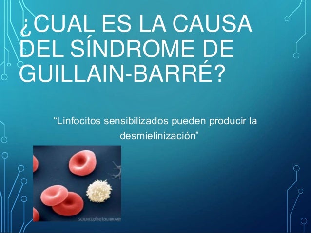 sindrome de guillain barre pdf