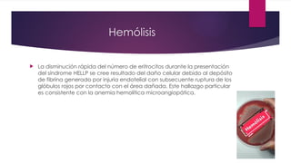 Hemólisis
 La disminución rápida del número de eritrocitos durante la presentación
del síndrome HELLP se cree resultado del daño celular debido al depósito
de fibrina generado por injuria endotelial con subsecuente ruptura de los
glóbulos rojos por contacto con el área dañada. Este hallazgo particular
es consistente con la anemia hemolítica microangiopática.
 