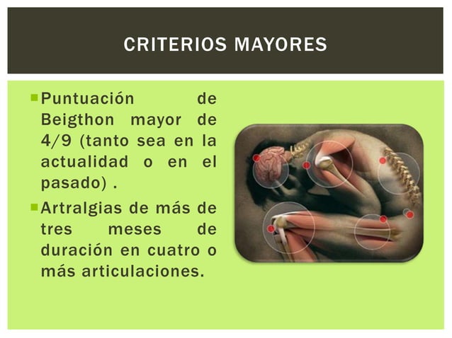 Síndrome de hiperlaxitud articular