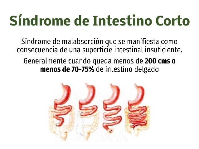 Imagen relacionada