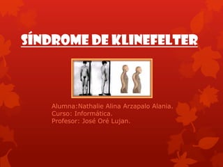 Síndrome de Klinefelter
Alumna:Nathalie Alina Arzapalo Alania.
Curso: Informática.
Profesor: José Oré Lujan.
 