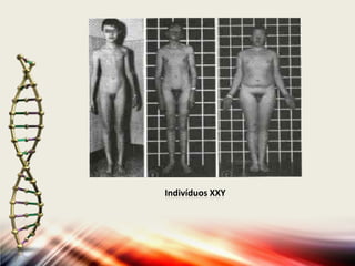 Indivíduos XXY
 