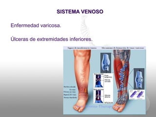SISTEMA VENOSO
Enfermedad varicosa.
Úlceras de extremidades inferiores.
 