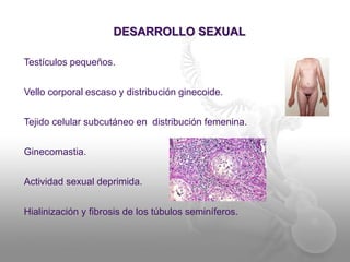 DESARROLLO SEXUAL 
Testículos pequeños. 
Vello corporal escaso y distribución ginecoide. 
Tejido celular subcutáneo en distribución femenina. 
Ginecomastia. 
Actividad sexual deprimida. 
Hialinización y fibrosis de los túbulos seminíferos. 
 