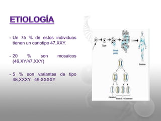 • Un 75 % de estos individuos 
tienen un cariotipo 47,XXY. 
• 20 % son mosaicos 
(46,XY/47,XXY) 
• 5 % son variantes de tipo 
48,XXXY 49,XXXXY 
 