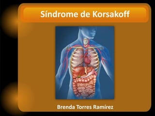 Síndrome de Korsakoff

Brenda Torres Ramírez

 