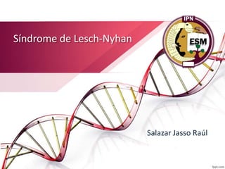 Síndrome de Lesch-Nyhan
Salazar Jasso Raúl
 