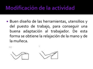  Buen diseño de las herramientas, utensilios y
del puesto de trabajo, para conseguir una
buena adaptación al trabajador. De esta
forma se obtiene la relajación de la mano y de
la muñeca.
 