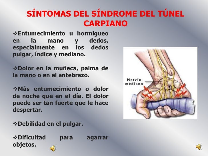 Síndrome del tunel carpiano convocatoria Síndrome del tunel carpiano convocatoria