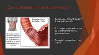 ¿Qué es el Síndrome de Mallory Weiss?
 Descrito por Kenneth Mallory y
Soma Weiss en 1929.
 Son desgarros no perforantes
de la membrana mucosa
gastroesofágica.
 Secundarios a vómitos o tos
fuerte.
 