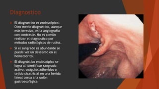 Diagnostico
 El diagnostico es endoscópico.
Otro medio diagnostico, aunque
más invasivo, es la angiografía
con contraste. No es común
realizar el diagnostico por
métodos radiológicos de rutina.
 Si el sangrado es abundante se
puede ver un descenso en el
hematocrito.
 El diagnóstico endoscópico se
logra al identificar sangrado
activo, coágulos adheridos o
tejido cicatricial en una herida
lineal cerca a la unión
gastroesofágica
 