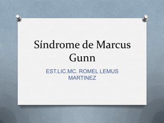Síndrome de Marcus
Gunn
EST.LIC.MC. ROMEL LEMUS
MARTINEZ
 