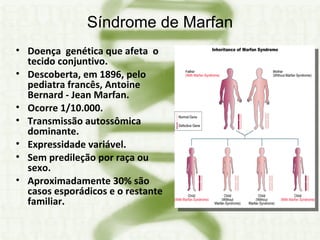 Síndrome de Marfan Doença  genética que afeta  o tecido conjuntivo. Descoberta, em 1896, pelo pediatra francês, Antoine Bernard - Jean Marfan. Ocorre 1/10.000. Transmissão autossômica dominante. Expressidade variável. Sem predileção por raça ou sexo. Aproximadamente 30% são casos esporádicos e o restante familiar. 