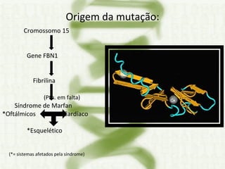Origem da mutação: Cromossomo 15 Gene FBN1 Fibrilina  (Ptn. em falta) Síndrome de Marfan  *Oftálmicos  *Cardíaco *Esquelético (*= sistemas afetados pela síndrome) 
