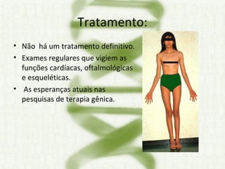 Tratamento: Não  há um tratamento definitivo. Exames regulares que vigiem as funções cardíacas, oftalmológicas e esqueléticas. As esperanças atuais nas pesquisas de terapia gênica. 