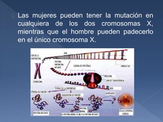 Las mujeres pueden tener la mutación en
cualquiera de los dos cromosomas X,
mientras que el hombre pueden padecerlo
en el único cromosoma X.
 