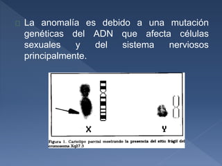 La anomalía es debido a una mutación
genéticas del ADN que afecta células
sexuales y del sistema nerviosos
principalmente.
 