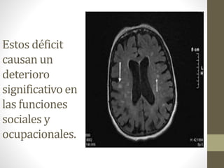 Estos déficit
causan un
deterioro
significativo en
las funciones
sociales y
ocupacionales.
 