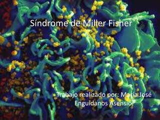 Síndrome de Miller Fisher

Trabajo realizado por: María José
Enguidanos Asensio.

 