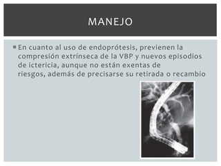 MANEJO

 En cuanto al uso de endoprótesis, previenen la
  compresión extrínseca de la VBP y nuevos episodios
  de ictericia, aunque no están exentas de
  riesgos, además de precisarse su retirada o recambio
 