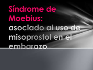 Síndrome de
Moebius:
 