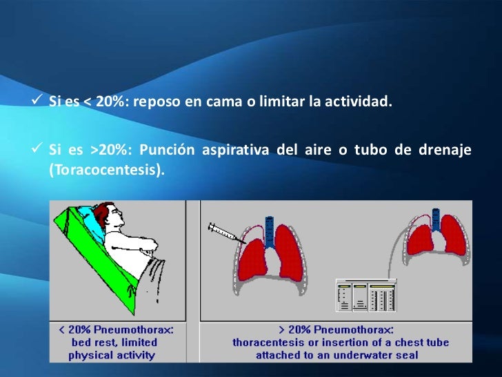 El dolor en el lado izquierdo de la espalda los medios públicos