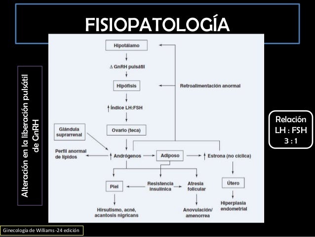 Síndrome de ovario poliquístico Síndrome de ovario poliquístico