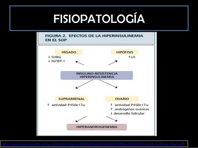 Síndrome de ovario poliquístico Síndrome de ovario poliquístico