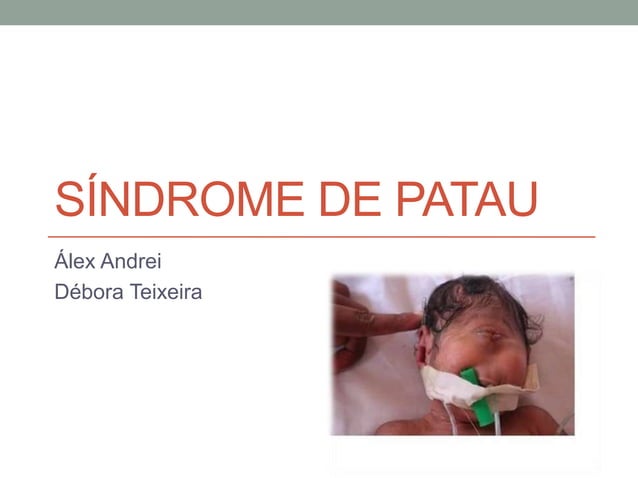 Síndrome de patau | PPTX