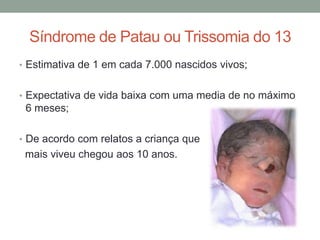 Síndrome de Patau ou Trissomia do 13
• Estimativa de 1 em cada 7.000 nascidos vivos;
• Expectativa de vida baixa com uma media de no máximo
6 meses;
• De acordo com relatos a criança que
mais viveu chegou aos 10 anos.
 