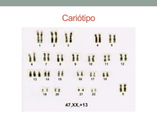Cariótipo
 
