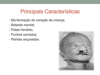 Principais Características
• Má formação do coração da criança;
• Retardo mental;
• Palato fendido;
• Punhos cerrados;
• Plantas arqueadas.
 