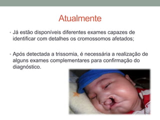 Atualmente
• Já estão disponíveis diferentes exames capazes de
identificar com detalhes os cromossomos afetados;
• Após detectada a trissomia, é necessária a realização de
alguns exames complementares para confirmação do
diagnóstico.
 
