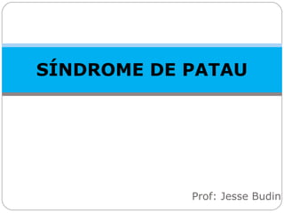 SÍNDROME DE PATAU
Prof: Jesse Budin
 